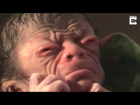 download lagu mp3 mp4 Benjamin Button Real, download lagu Benjamin Button Real gratis, unduh video klip Benjamin Button Real