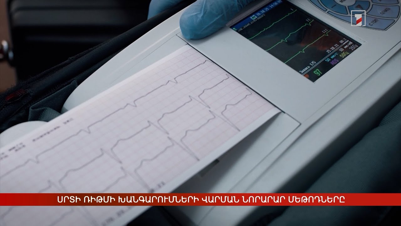 Սրտի ռիթմի խանգարումների վարման նորարար մեթոդները