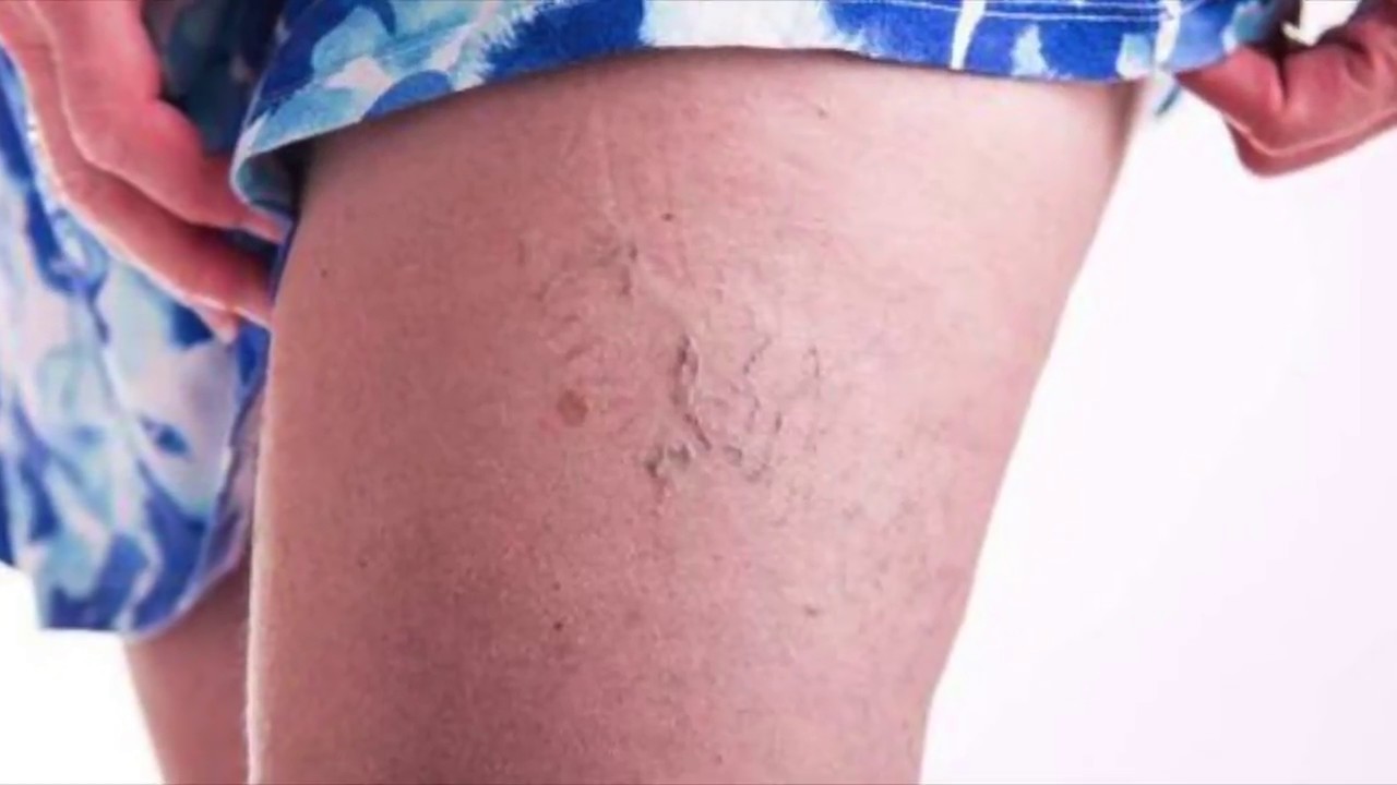 Cesar Augusto Torres Velarde-10