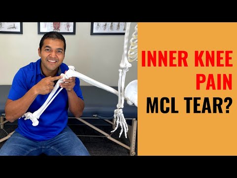 Is Your Painful Inner Knee Problem Really An MCL Tear? [Symptoms & Diagnosis]