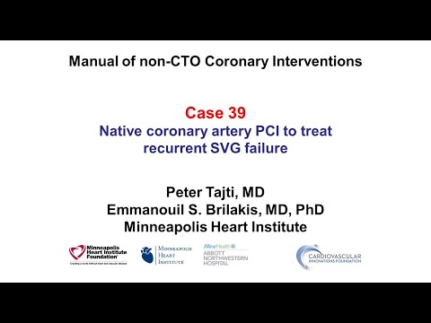 Case 39: PCI Manual - Native instead of SVG PCI