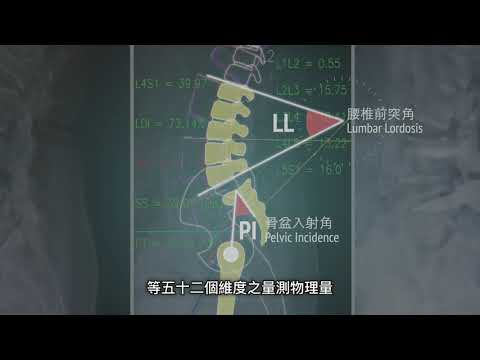 腰椎X光片智慧量測技術