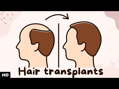 All About Allergy Shots