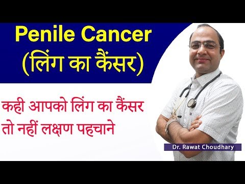 Penile Cancer | Homeopathic Treatment of Penile Cancer | लिंग के कैंसर का इलाज
