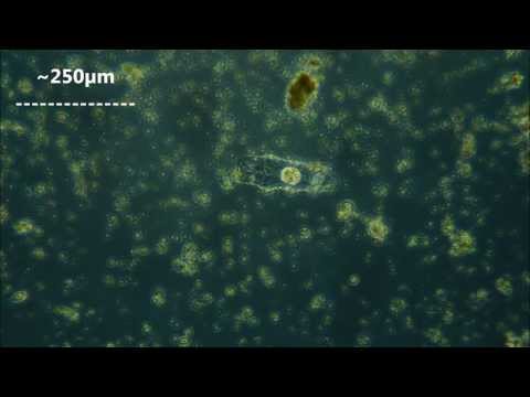 Hatching tardigrades (time-lapse)