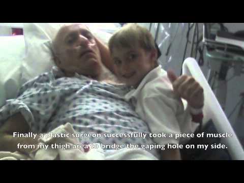 Howard Sadwin's Story