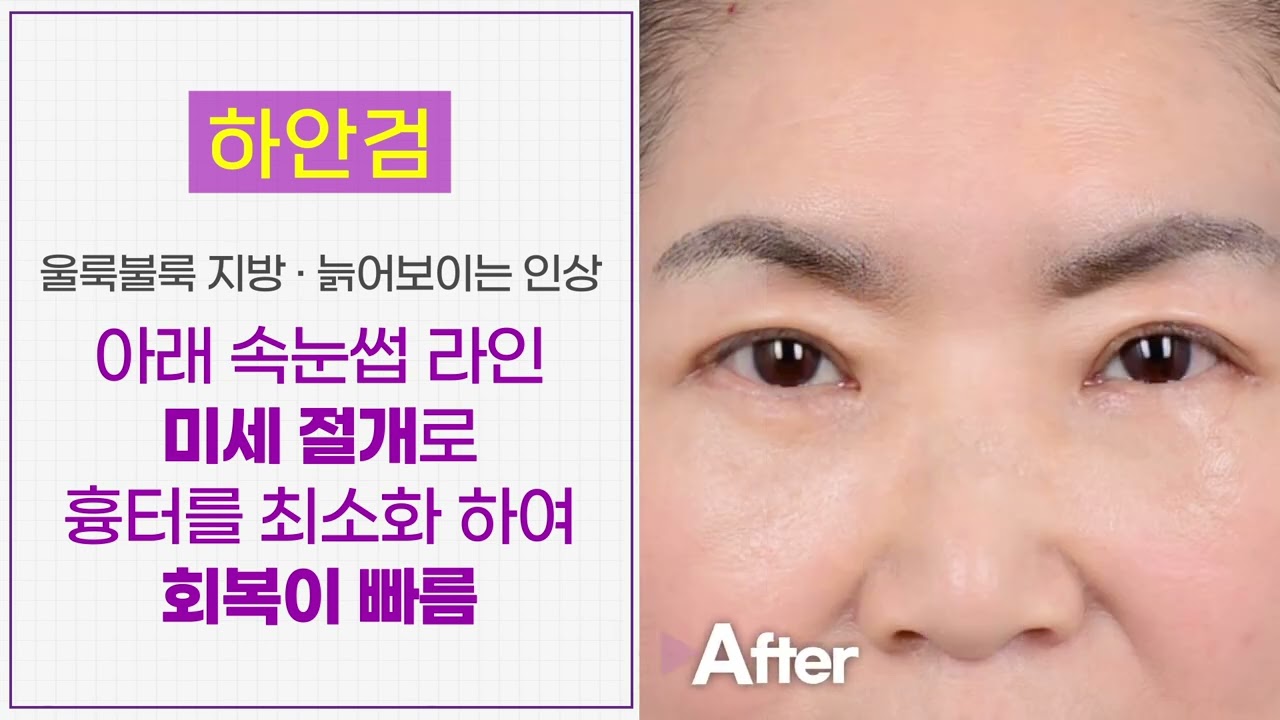 �ϾȰ��� ���� �ش����?