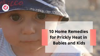 10 Home Remedies for Prickly Heat in Babies and Kids