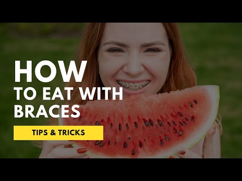 How to Eat Food with BRACES | Foods You Should Eat / Avoid