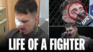 The Truth Behind Tom Aspinall's UFC 321 Eye Poke