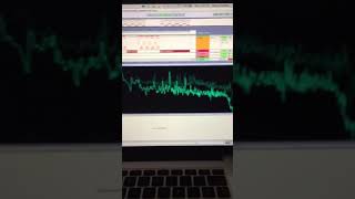 16 Bit- SkullCrack (Svdden Death Bootleg)