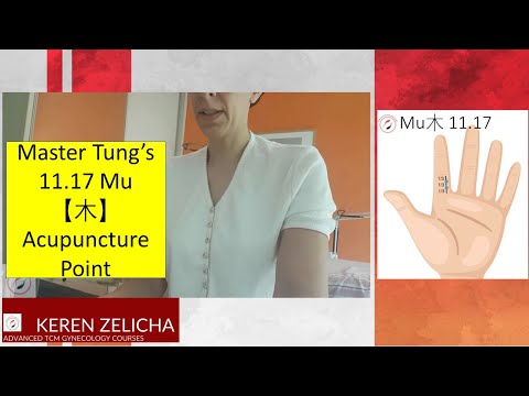 Master Tung's 11.17 Mu Acupuncture Point