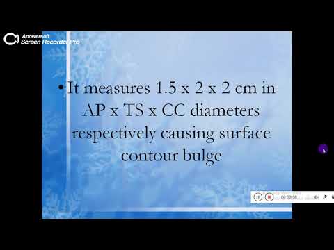 Quiz powerpoint video - Case 174- Refresh your knowledge