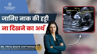 Absent Nasal Bone By Dr. Priya Bhave Chittawar