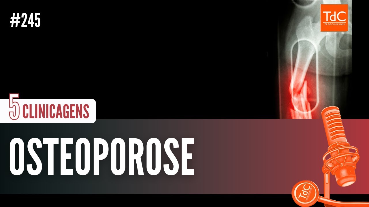 Episódio 245 - OSTEOPOROSE - 5 CLINICAGENS