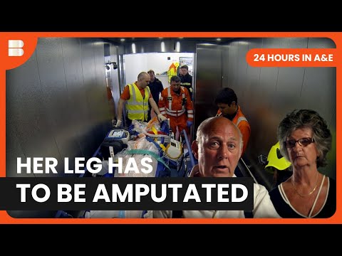 Her Leg Has To Be Amputated | 24 Hours in A&E | Medical Documentary