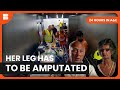 Her Leg Has To Be Amputated 24 Hours In A E Medical Documentary