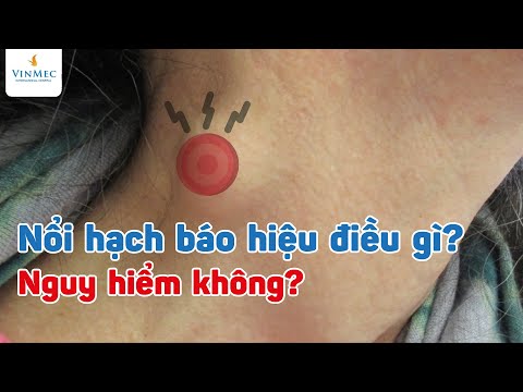 , title : 'Nổi hạch báo hiệu điều gì? Nguy hiểm không?'