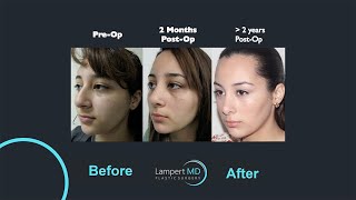 Lampert Md Plastic Surgery