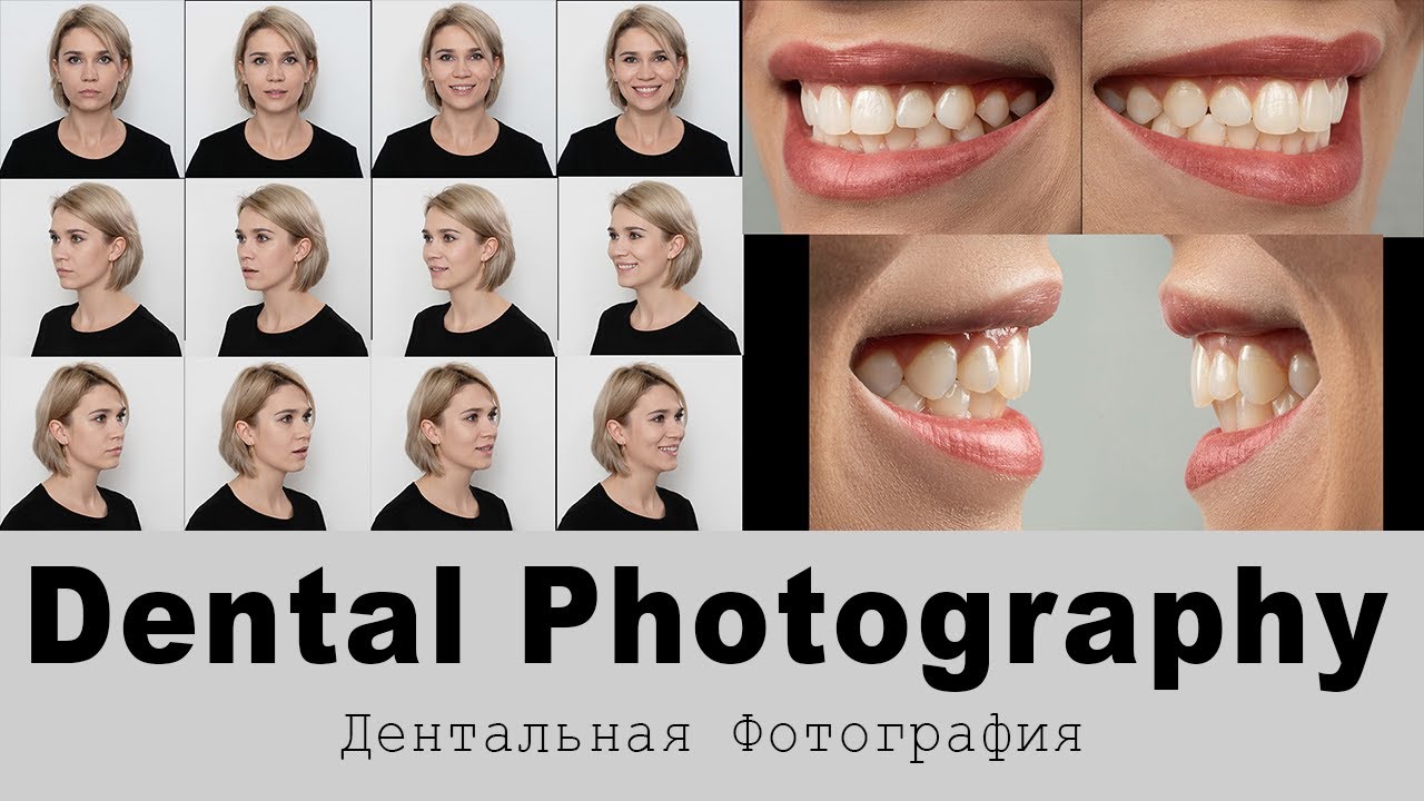 Фотопротокол В Стоматологии — Name-scan.ru