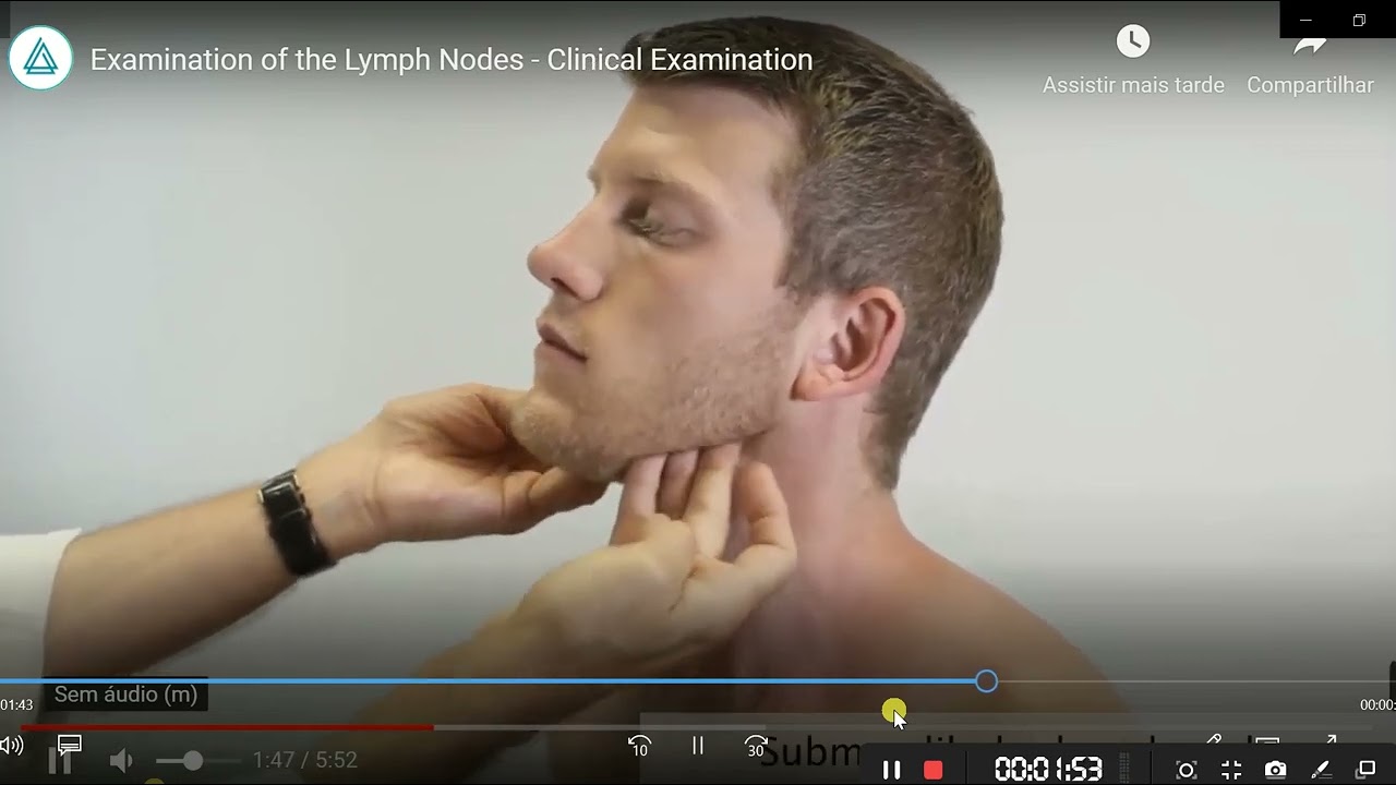 EXAME DE CABEÇA E PESCOÇO: INSPEÇÃO E PALPAÇÃO DE LINFONODOS