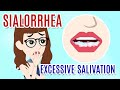 SIALORRHEA EXCESSIVE SALIVATION Causes Diagnosis And Treatments