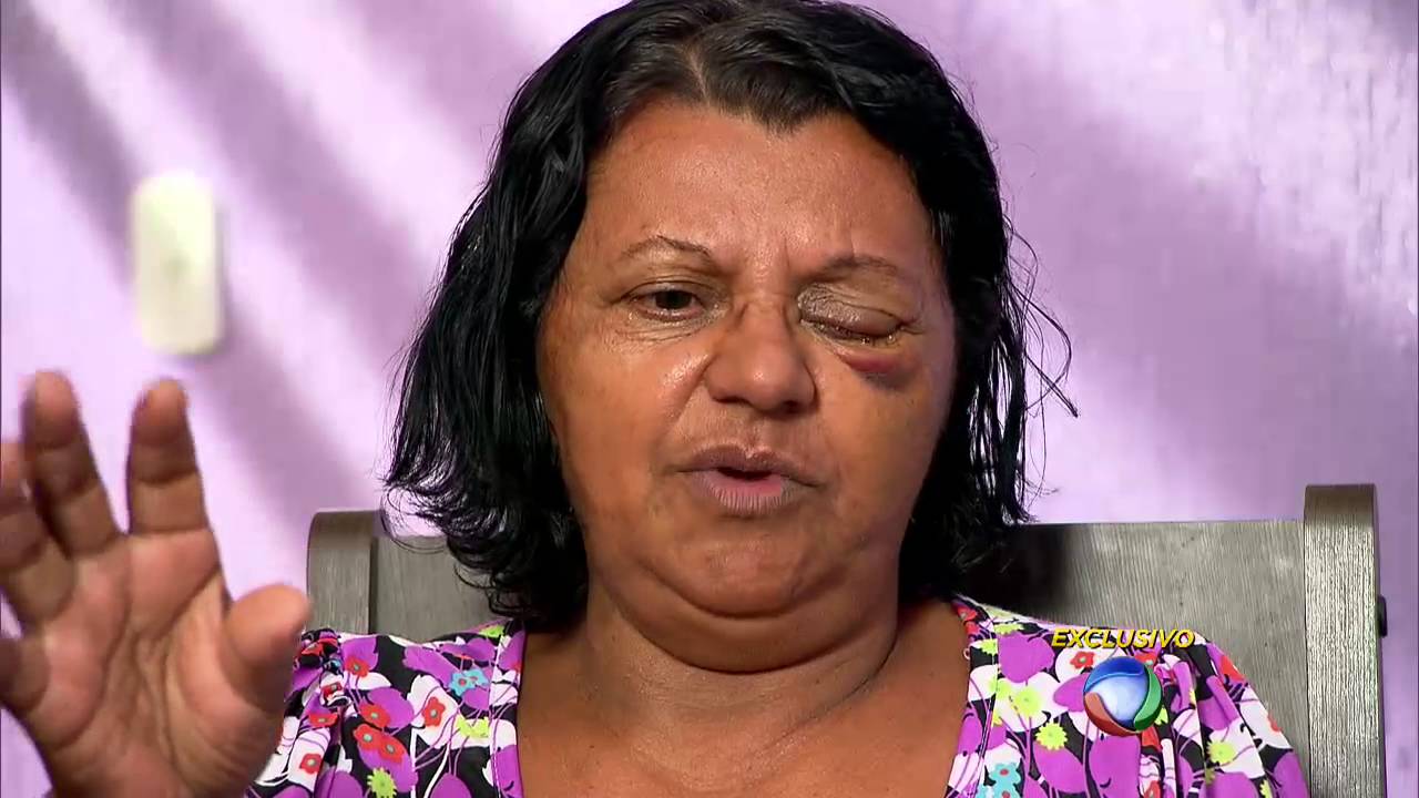 Médico responsável pelo mutirão de cirurgia de catarata explica o que aconteceu