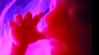 Unborn baby&#39;s prayer- Reality of Abortion guarenteed to Touch your heart.