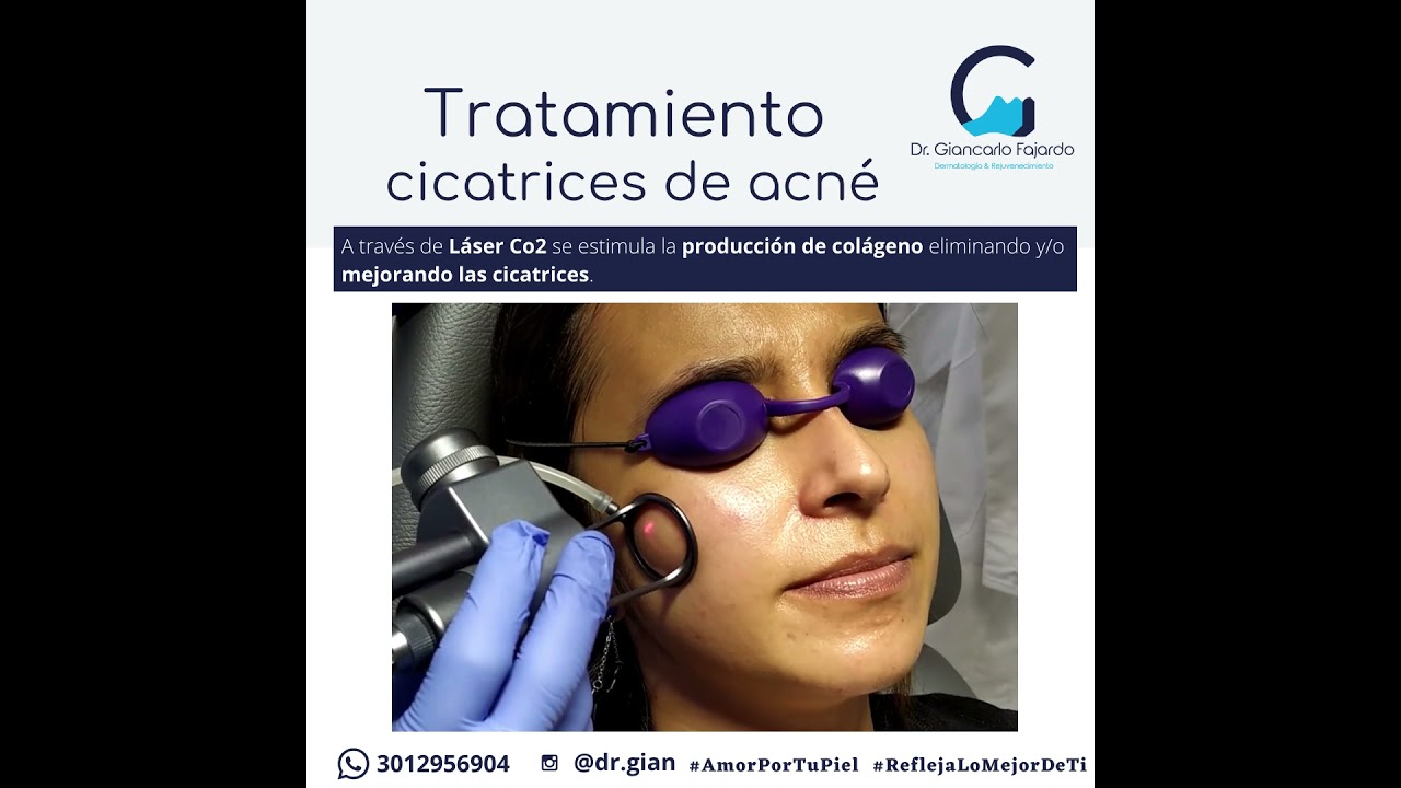 Giancarlo Alberto Fajardo Ramírez-9