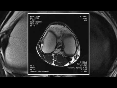 Ados ft. Crimes - Życie to nie kino (Prod. Rhyno)