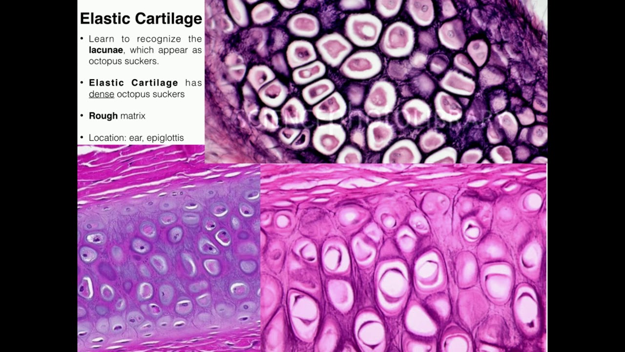 A&P I Lab | Exercise 4 Part 2: Connective Tissues