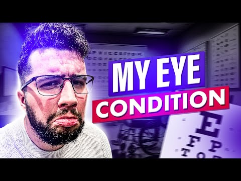 Keratoconus Reddit
