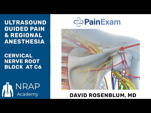 Ultrasound Guided Suprascapular Nerve Block & Ultrasound Exam of the Shoulder Joint & Biceps Tendon