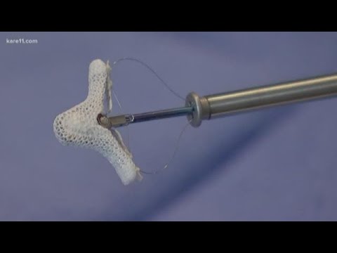 Small device shows big promise for heart patients