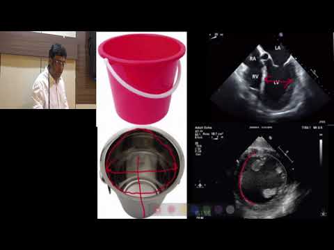 Role of TEE in hemodynamic assessment a case based approach