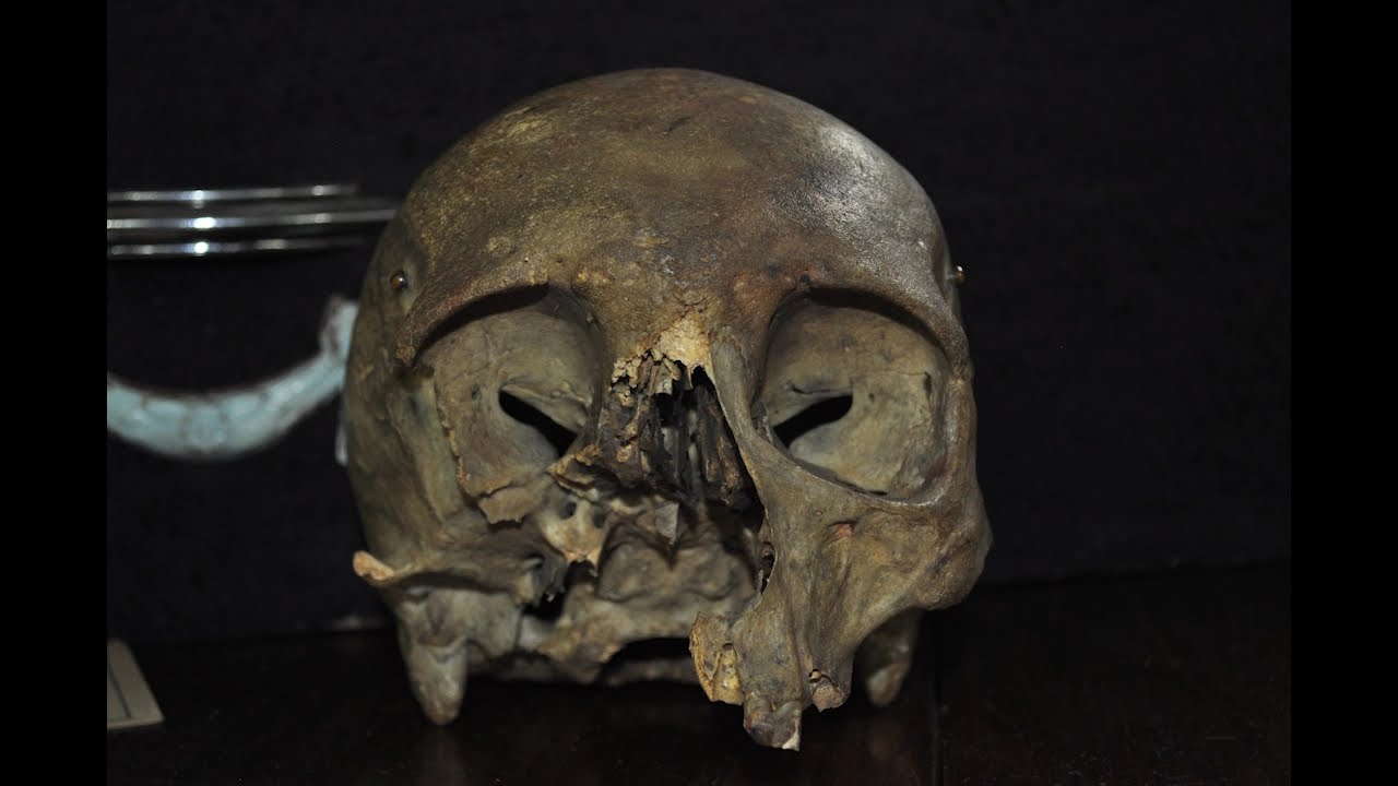 We found real human bones at the museum!?!