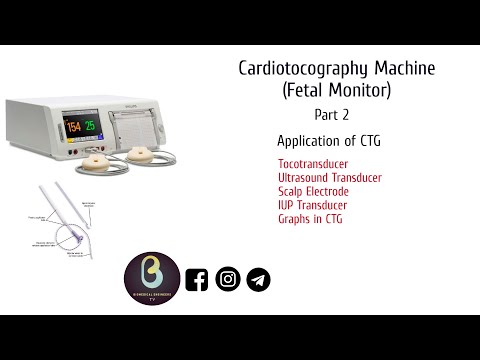 Cardiotocography Trailer