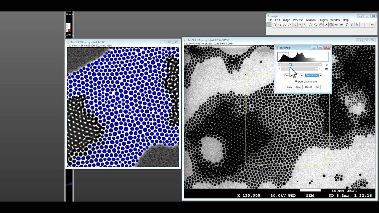 How to use ImageJ for nanoparticle size distribution analysis