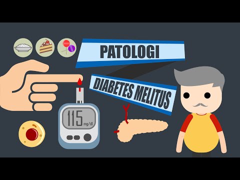 Cukor diabétesz szövődményei kezelése komplikációk