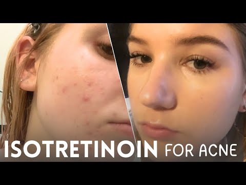 ACNETOIN -I 20MG CAPSULES