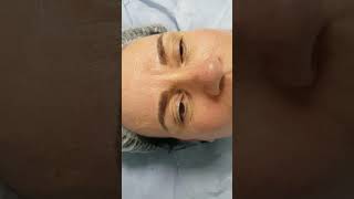 Realism 3D Microblading Eyebrows by El Truchan @ Perfect Definition