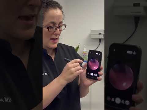 How To Use An Ear Camera:  Do You Have Ear Wax?