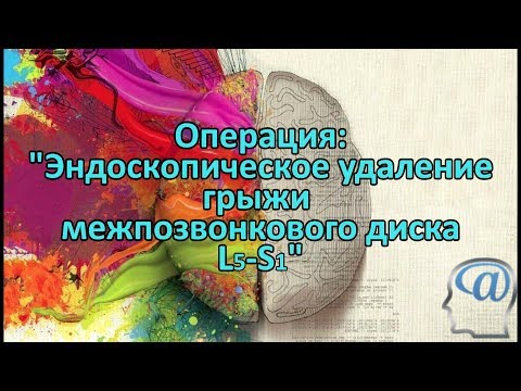 Бандаж на плечевой сустав фиксирующий повязка дезо Боль в горле в шее и слабость