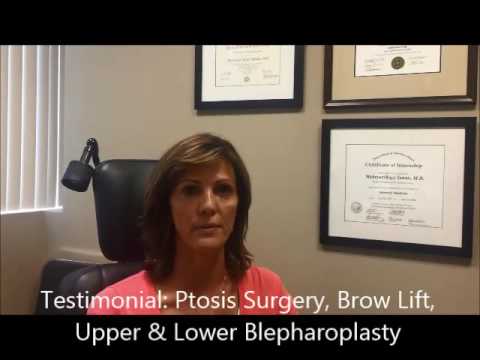 Patient Testimonial – Carrie – Upper & Lower Blepharoplasty, Brow Lift, & Ptosis Surgery Patient Testimonial – Carrie – Upper & Lower Blepharoplasty, Brow Lift, & Ptosis Surgery
