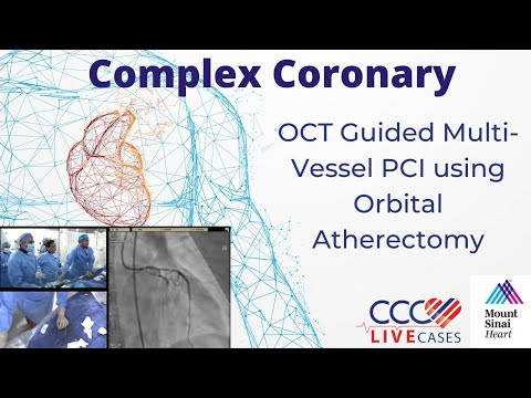 OCT Guided Multi-Vessel PCI using Orbital Atherectomy - March 19, 2019