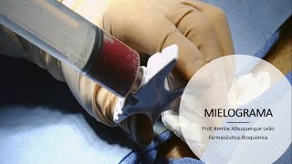 MIELOGRAMA: Técnica e interpretação