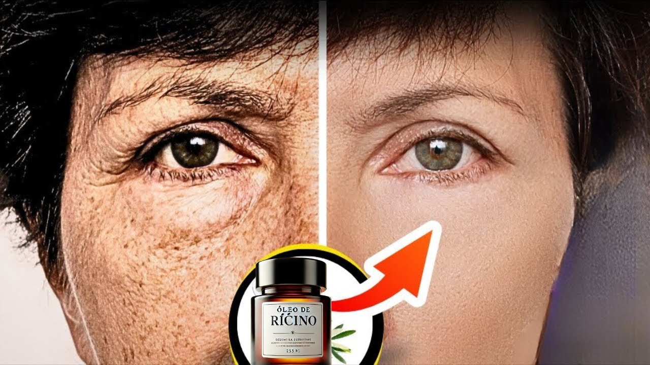 Óleo de Rícino para o Seu Rosto // O Botox Natural