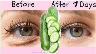 Japanese women beauty secrets to remove bags under eyes instantly in 1 days Under eye wrinkles fix