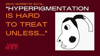 Hyperpigmentation Treatments, Products & Routines With Sean Garrett | Naked Beauty Podcast