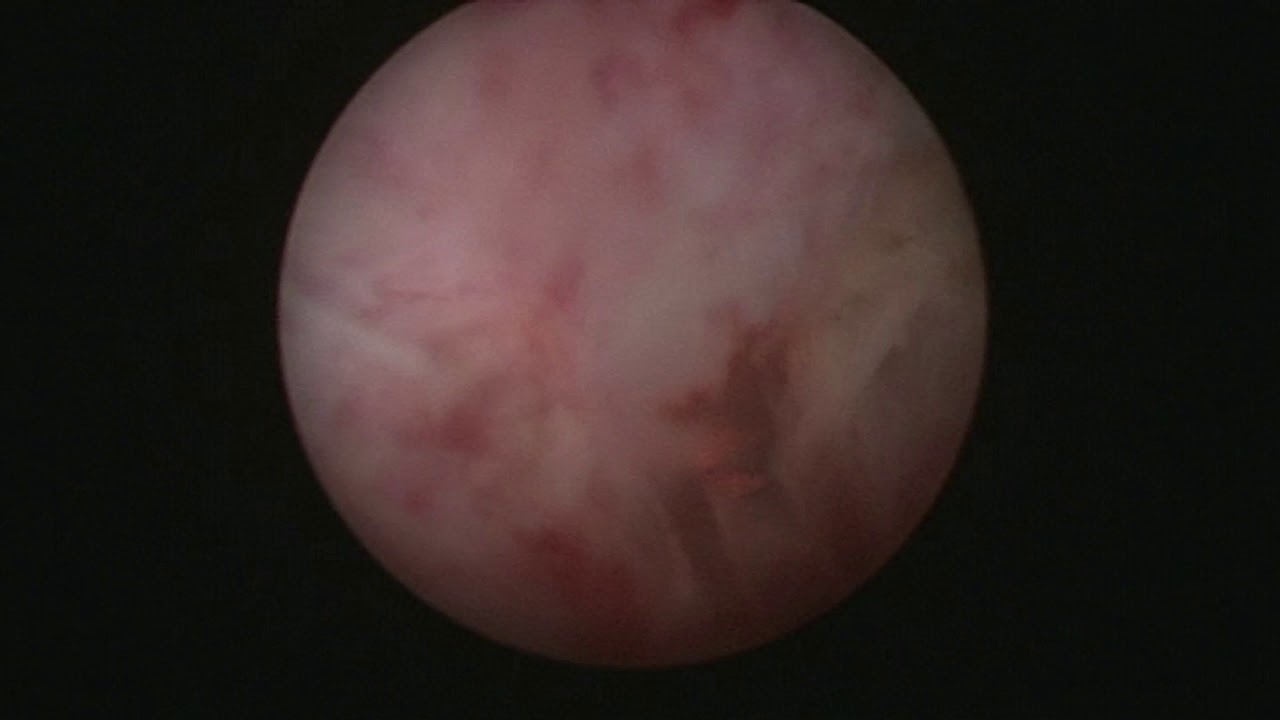 Francesco Chiaradia-8